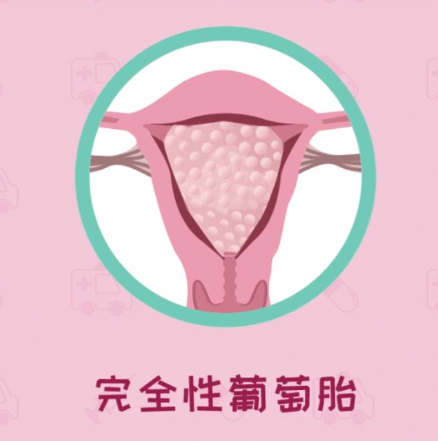 呼和浩特五洲醫院看病專業嗎HCG升高一定是懷孕嗎不可能還有詐