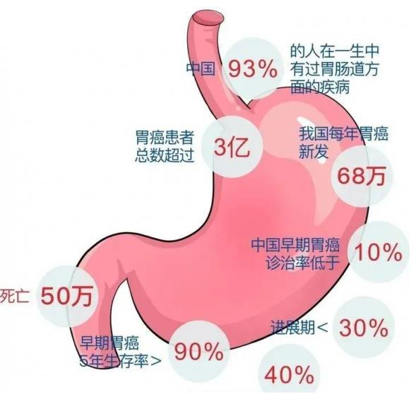 呼市東大肛腸醫(yī)院:無癥狀也能檢出胃早癌!五類人應(yīng)早做篩查,無痛苦的磁控膠囊胃鏡