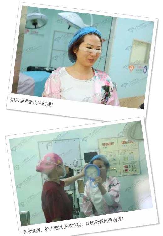 眼袋是怎么形成的,沈陽(yáng)杏林整形做眼袋多少錢(qián)
