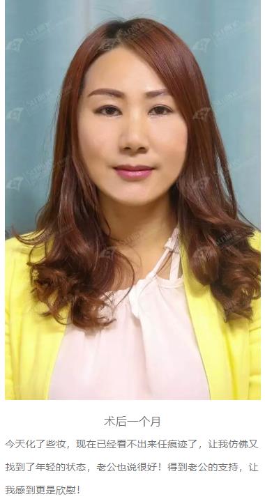 眼袋是怎么形成的,沈陽(yáng)杏林整形做眼袋多少錢(qián)