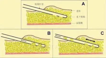 深圳悅美莉醫(yī)療門診部口碑怎么樣 誠(chéng)信行醫(yī)溫馨服務(wù)