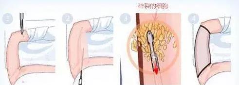深圳悅美莉醫(yī)療門診部口碑怎么樣 誠(chéng)信行醫(yī)溫馨服務(wù)