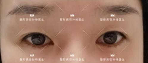 溫情時刻:這封1000字感謝信是對西安國際醫學中心整形醫院孫峰醫生的信任與期許