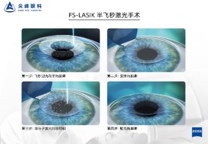 鄭州尖峰眼科:近視參軍適合做哪種近視手術(shù)?