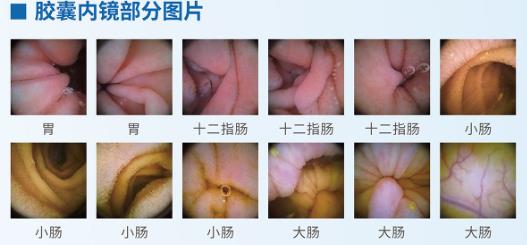 呼市東大肛腸醫院 反胃、吐酸水?胃酸過多是一種怎樣的體驗?