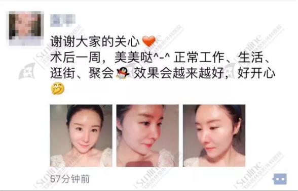 沈陽杏林整形隆鼻費(fèi)用貴嗎 效果好不好