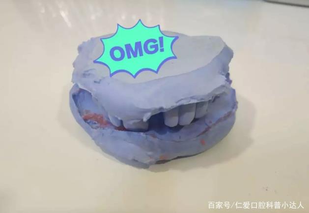 網友:缺牙怎么辦?武漢仁愛口腔種植專家帶您直擊種植手術現場,見證缺牙重生的秘密!