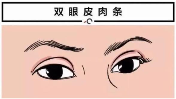 北京依一醫療美容武崇高 雙眼皮修復都在修復些什么?