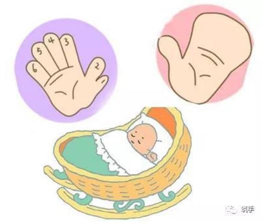 順德和平醫院手指再造怎么樣 先天性多指/并指畸形如何產生?如何治療?