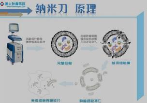 長沙腫瘤醫院推薦廣州復大腫瘤醫院:胰腺癌還有救嗎?