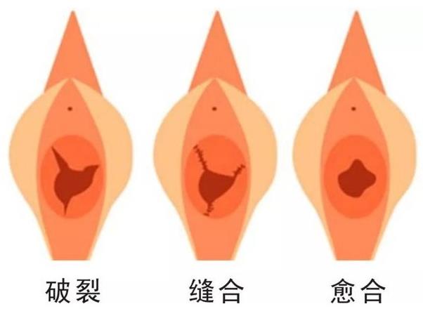 重慶軍科私密整形醫院,處女膜修復安不安全?