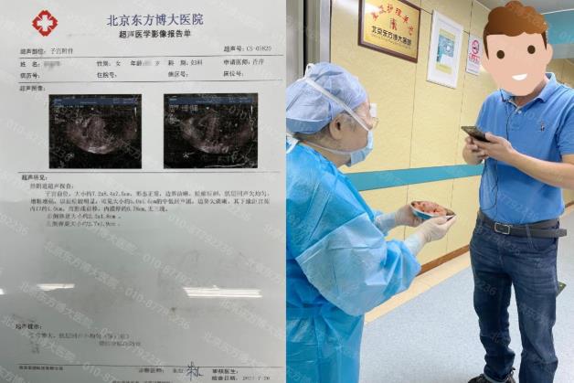 治療腺肌癥的方法分析 孫愛達教授還做手術嗎