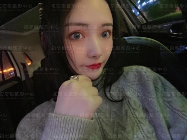 怎么設計才會好看 割雙眼皮就來南通初戀眼整形中心