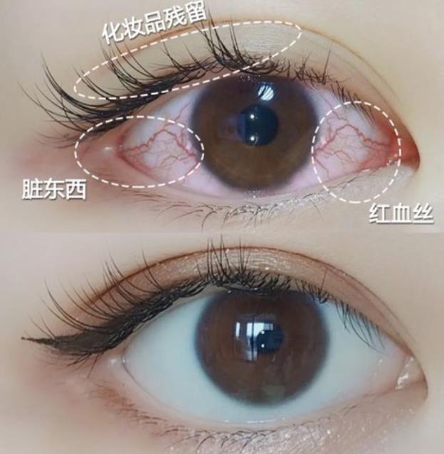 緩解眼干眼澀,眼用凝膠和眼藥水哪個(gè)好?