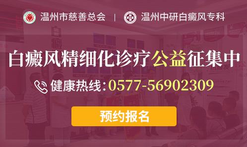 溫州中研白癜風(fēng)醫(yī)院正規(guī)嗎?白癜風(fēng)為啥復(fù)發(fā)呢