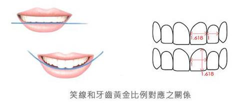 武漢仁愛口腔怎么樣?網友:為什么我笑的呆板顯老?牙醫:牙齒矯正中不可忽視的微笑線!