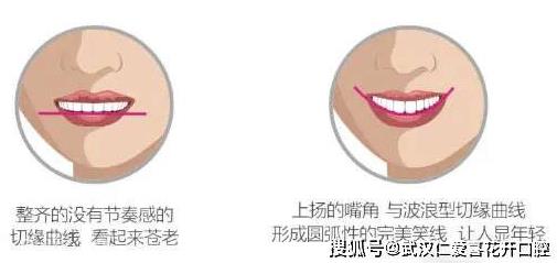 武漢仁愛口腔怎么樣?網友:為什么我笑的呆板顯老?牙醫:牙齒矯正中不可忽視的微笑線!