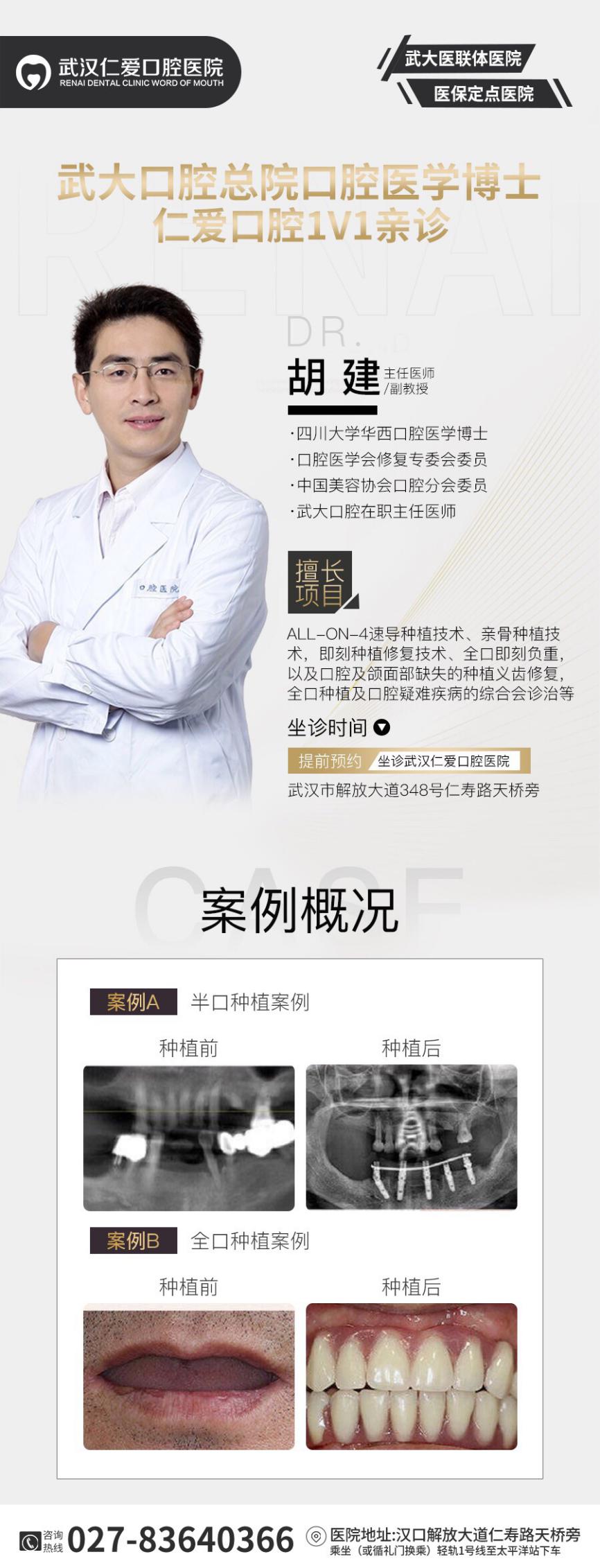 武漢仁愛口腔:種牙親身經歷分享(歷時4個月),解決年輕人的蛀牙缺牙煩惱!