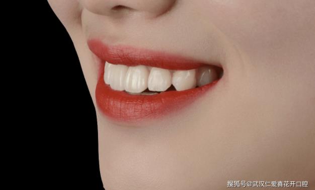 武漢仁愛口腔:種植牙真的能做嗎?20歲女孩的真實案例,告訴你種牙到底值不值!