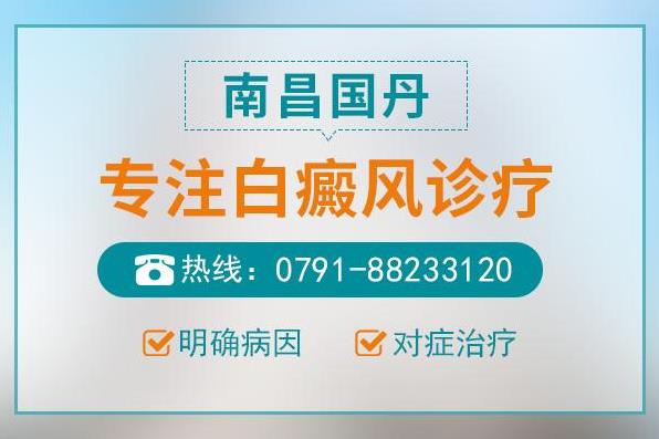 南昌國丹白癜風醫院怎么樣?臉上長了白斑能治好嗎?
