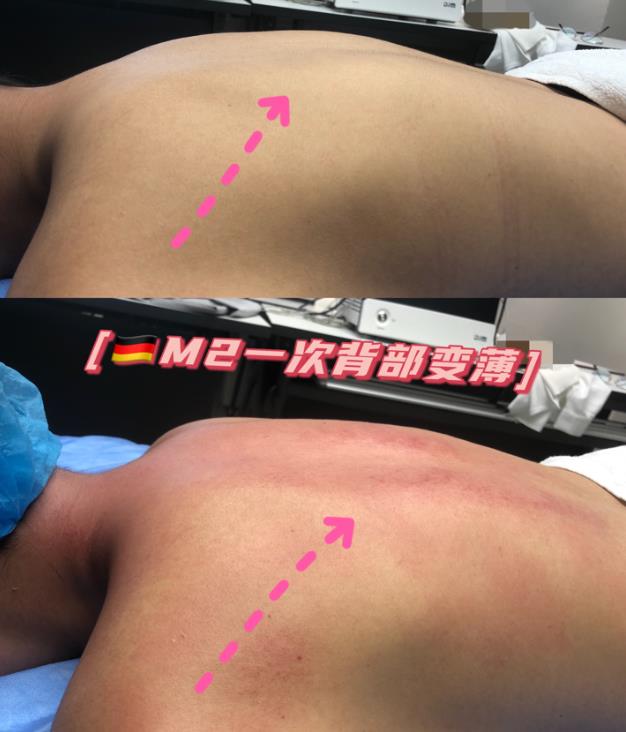 DJM-M2熱力緹效果好不好?由內而外喚醒你的身體