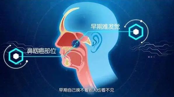成都民生耳鼻喉專科醫院陳建超教授解答 鼻咽癌怎么治