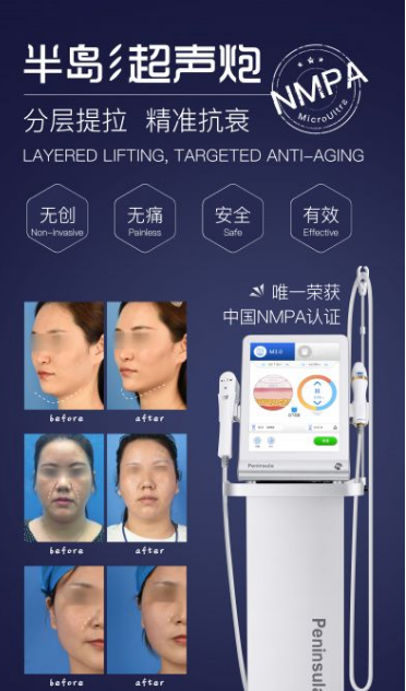 寧波藝星整形醫院:7D黃金超聲炮,深層抗衰,一次抵三次熱瑪吉!