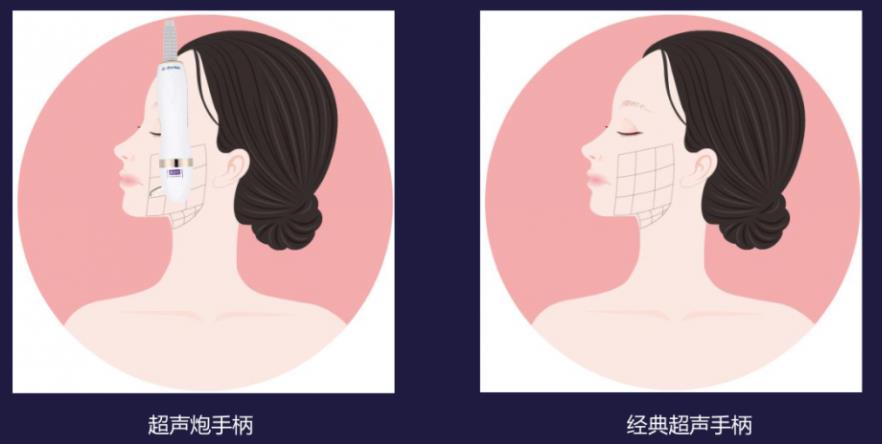寧波藝星整形醫院:7D黃金超聲炮,深層抗衰,一次抵三次熱瑪吉!
