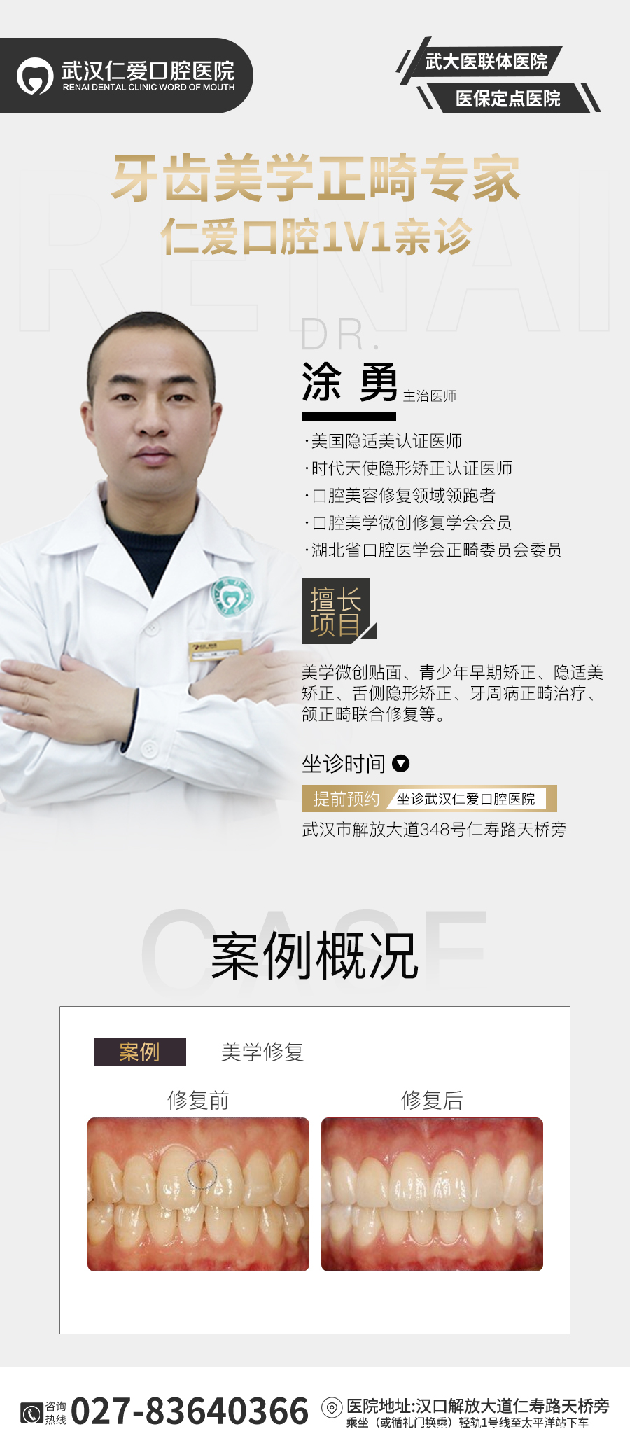 武漢仁愛口腔 數(shù)字化即刻美學(xué)貼面案例分享