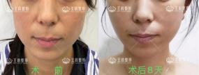 45歲后我開始研究起了“王的整形內窺鏡駐顏術”