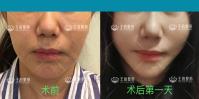 45歲后我開始研究起了“王的整形內窺鏡駐顏術”