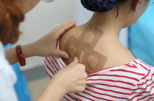 三伏貼可以買(mǎi)來(lái)自己貼嗎?什么體質(zhì)的人不適合貼三伏貼