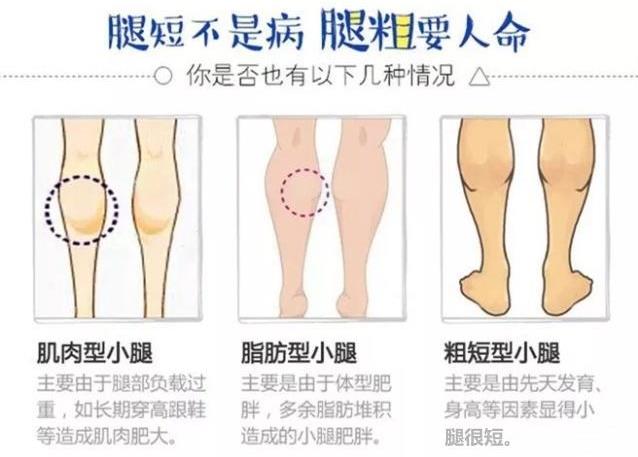 吸脂醫(yī)生關幾夢:吸脂瘦腿可以解決肥胖腿型嗎?