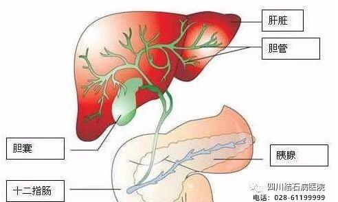 還在猶豫“切膽”還是“保膽”?四川結石病醫院告訴你答案!