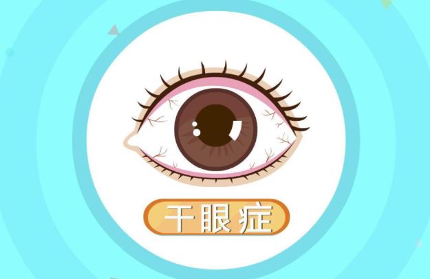 浙江省眼科醫院之江院區王勤美院長科普:干眼能做近視手術嗎?