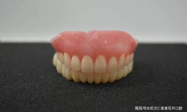 武漢口腔醫院修復案例像種植牙一樣“穩固”的活動假牙