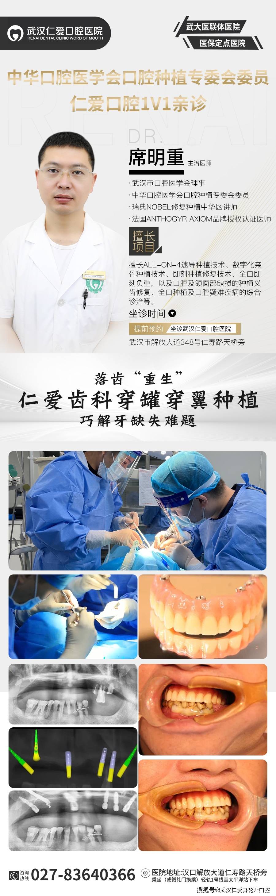 武漢口腔醫院修復案例像種植牙一樣“穩固”的活動假牙