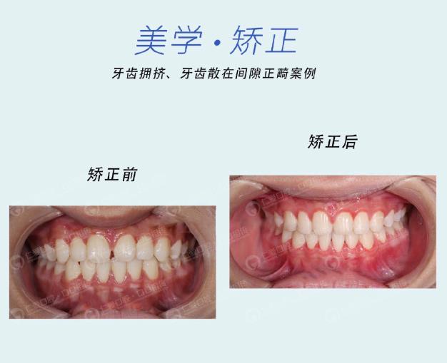 武漢仁愛(ài)口腔牙齒矯正技術(shù)好不好?