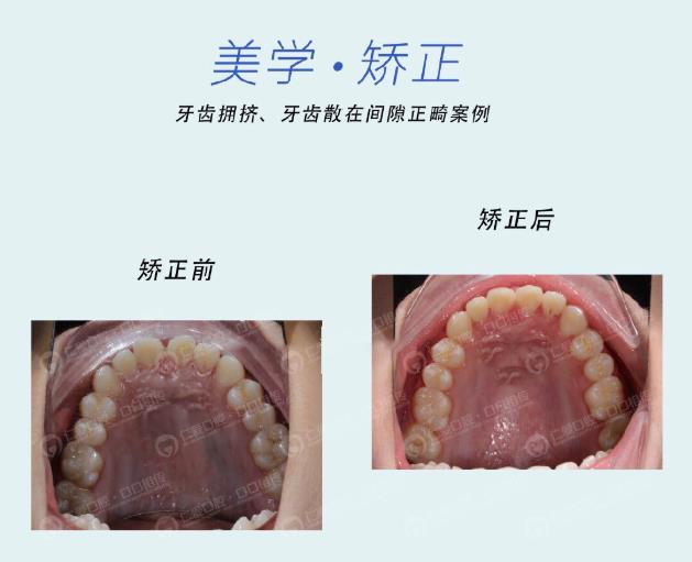 武漢仁愛(ài)口腔牙齒矯正技術(shù)好不好?
