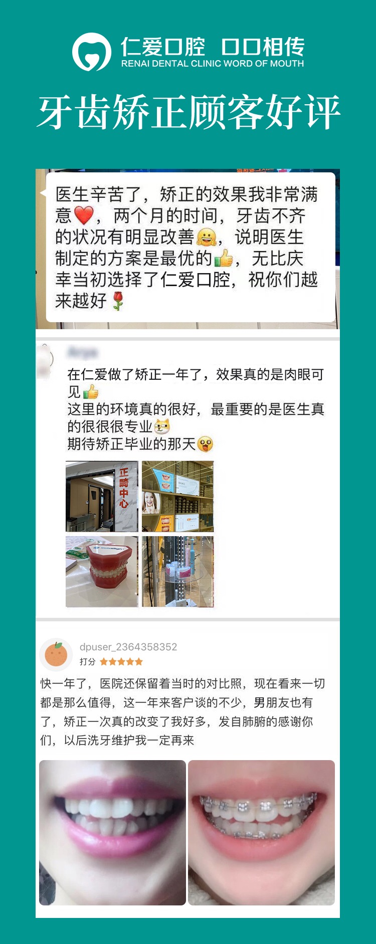 武漢仁愛口腔怎么樣,種植牙醫生及隱形矯正案例