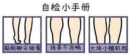 小腿吸脂為何是難點?廣州高尚形體雕塑來解疑