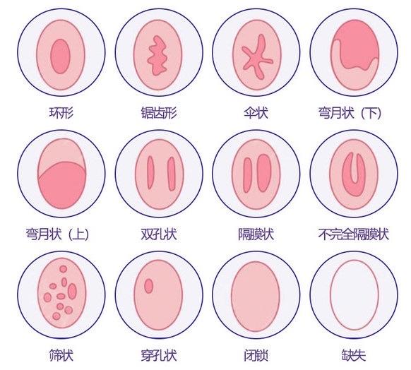 重慶哪家私密整形醫(yī)院做處女膜修復專業(yè)?