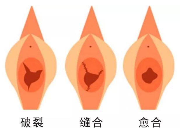 重慶哪家私密整形醫(yī)院做處女膜修復專業(yè)?