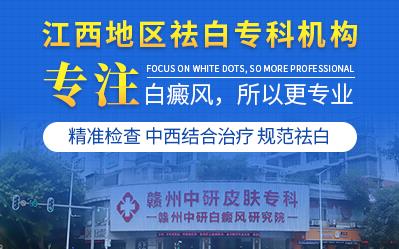 贛州中研皮膚病醫院治療白癜風技術好 胡亂用藥危害大!