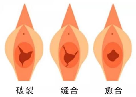 重慶最好的陰道緊縮醫院是哪家?