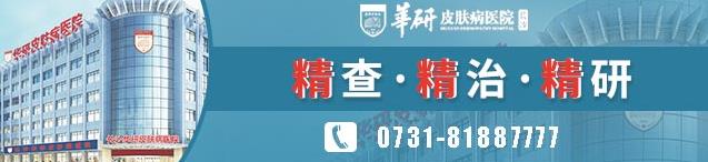 長沙華研白癜風醫(yī)院治白癜風能治好嗎