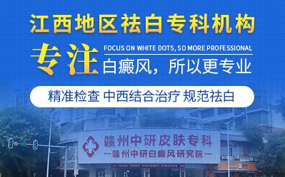 贛州中研皮膚病醫(yī)院張立志醫(yī)生看診好 白癜風(fēng)患者吸煙的危害!