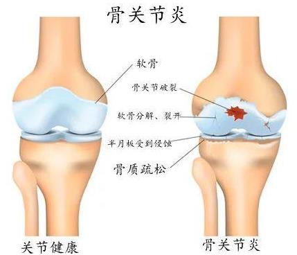 重慶哪個骨科醫院好-重慶看關節炎哪里好?重慶紅樓醫院
