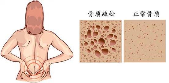 重慶哪個骨科醫院好-重慶看關節炎哪里好?重慶紅樓醫院