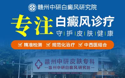 贛州中研白癜風醫(yī)院專業(yè)嗎?白癜風可以靠藥物控制嗎? 400-250-2.jpg